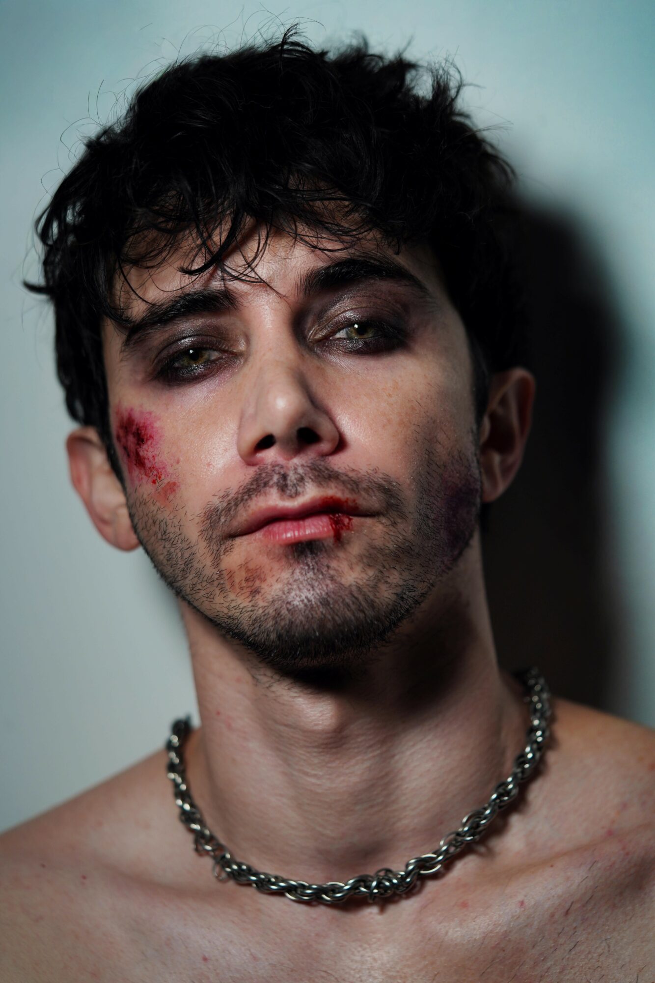 Young man with messy dark hair, facial injuries, and a chain necklace, looking at the camera with a neutral expression.