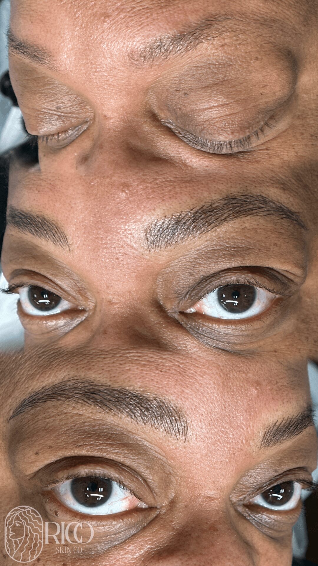 Close-up of a person's eyes and eyebrows, showing different eyelid and eyebrow conditions across three sections.