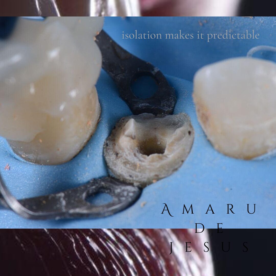Close-up of dental crowns and a dental implant on a blue surface with text in the background.
